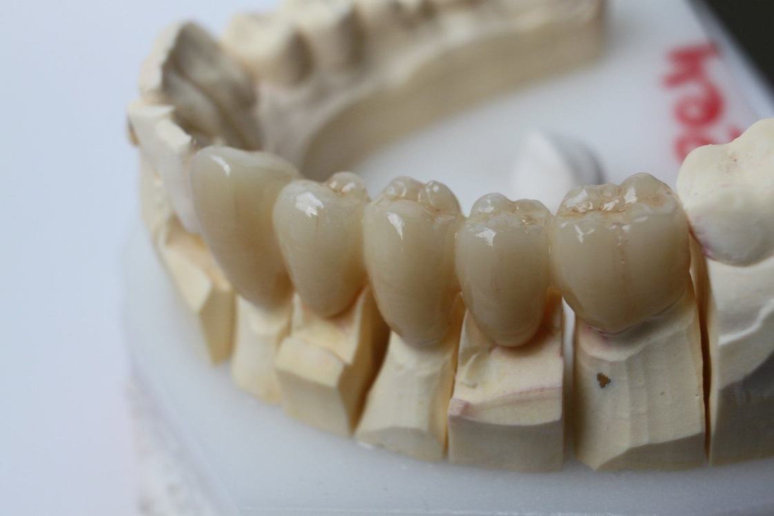 Yucera 1200MPa Bending Strength HT Zirconia Dental Block and White Block Blank for Dental Equipment Laboratory and Tooth Gems