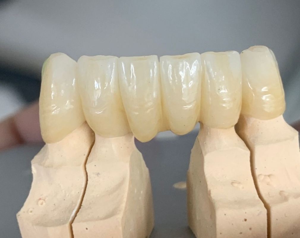 Yucera 3D Pro Multilayer Open System Pre-shaded Dental Zirconia Blocks CADCAM Dental Ceramic Block for Lab