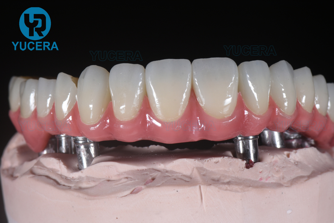 Hot Sale 4D Dental Ceramic Pre-Shaded Multilayer  Zirconia Block Cad Cam Dental Lab for Half Mouth