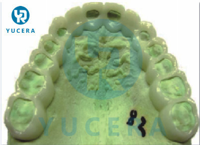 Flexibles Prothesenmaterial 16 Farben Rosa Klar Dental PMMA Flexibler Disc