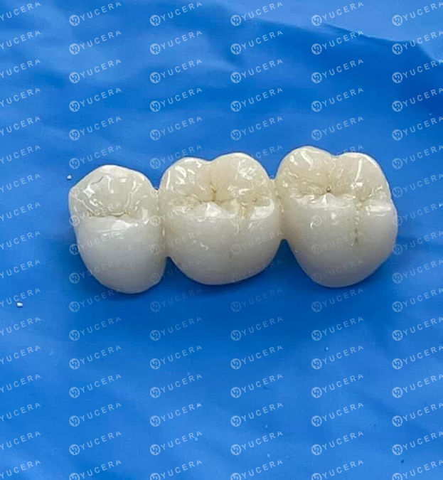 Yucera Cam Maschine für Dentallabor, Dental-Sinterofen für Zirkonoxid-Material