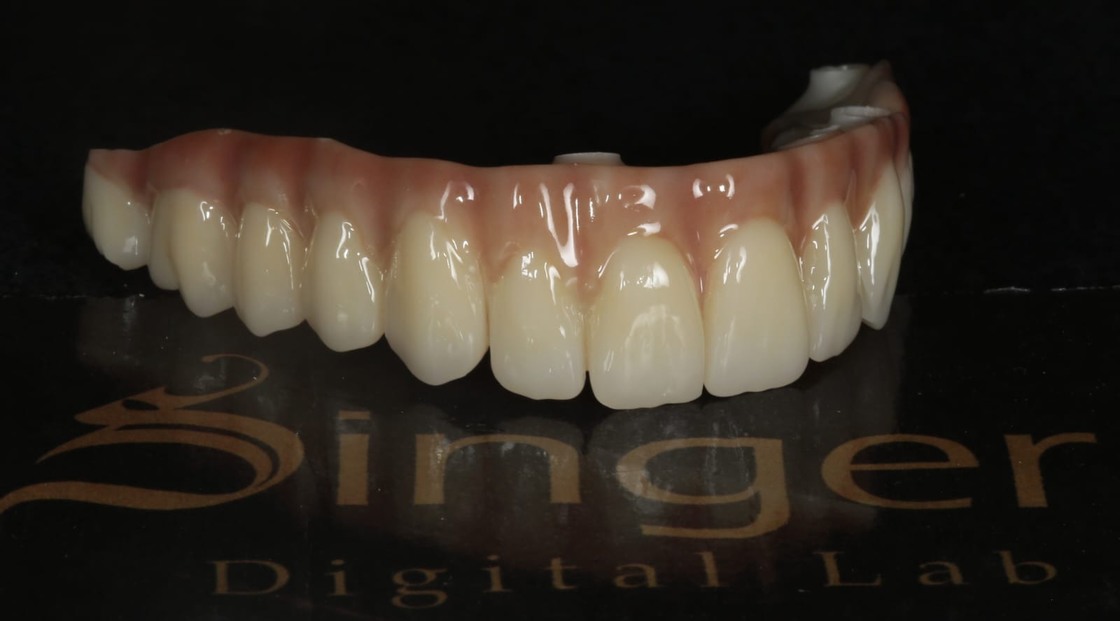 Yucera 4D Pro Dental - Spezifischer Zirkoniumdioxid-Keramikblock mit HT Plus Technologie zur Verbesserung der Qualität von Restaurationen