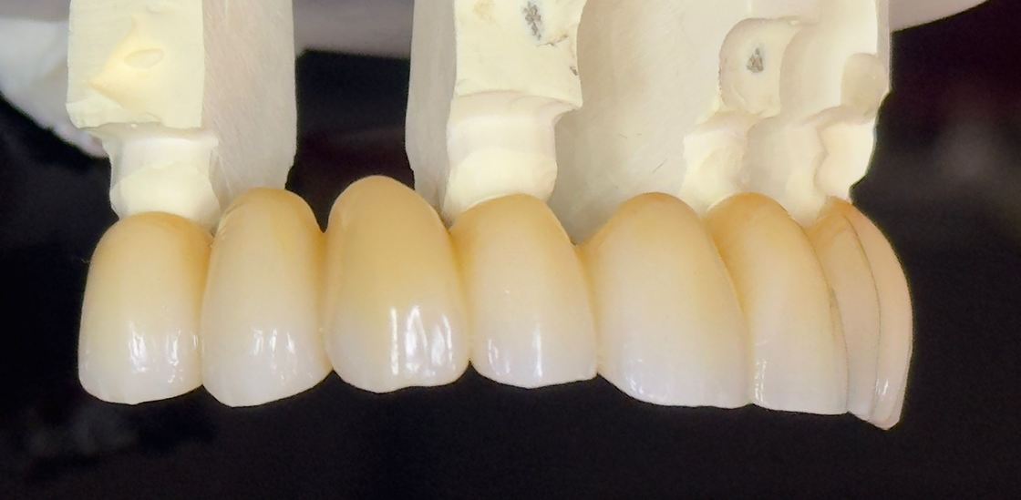 Yucera 4D Pro Zirconia Blocks for Dental Laboratories