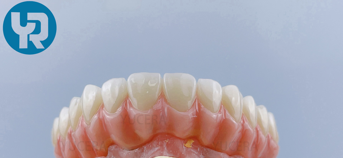 Yucera 4D Pro Zirconia Blocks for Dental Laboratories