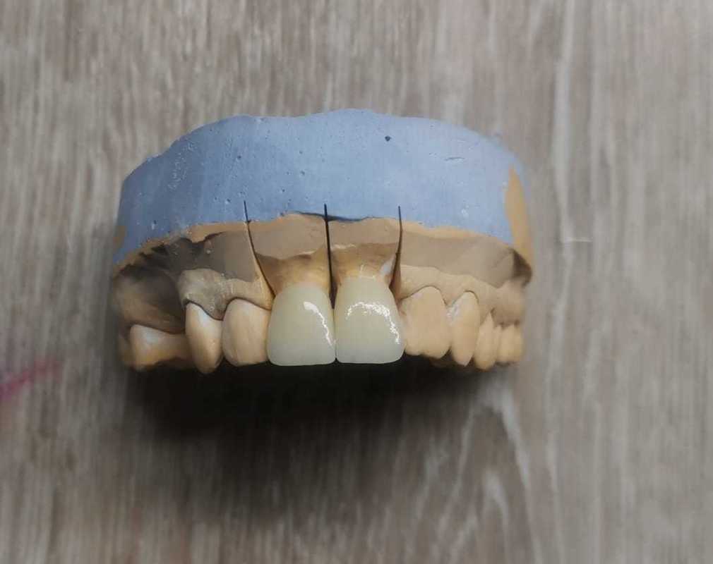 Yucera ST color Dental Zirconia Discs Perfectly Paired with Our High Quality Blocks