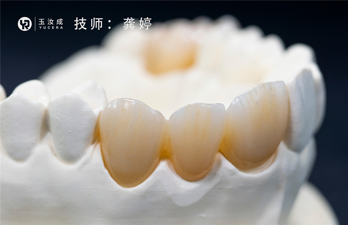 Yucera 3D plus offenes System des Multilaer-Zirkoniumdioxid-Block-98x16mm für hintere Krone